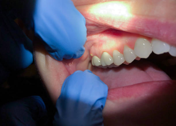  Wakefield, KS Emergency Dentist Pros