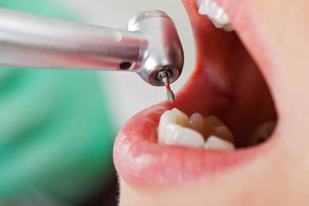 Best Emergency Broken Tooth Repair in Wakefield, KS